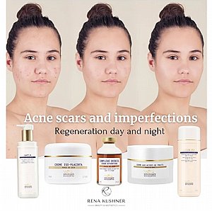  ����� ���� ���� �� ACNES CARS SET